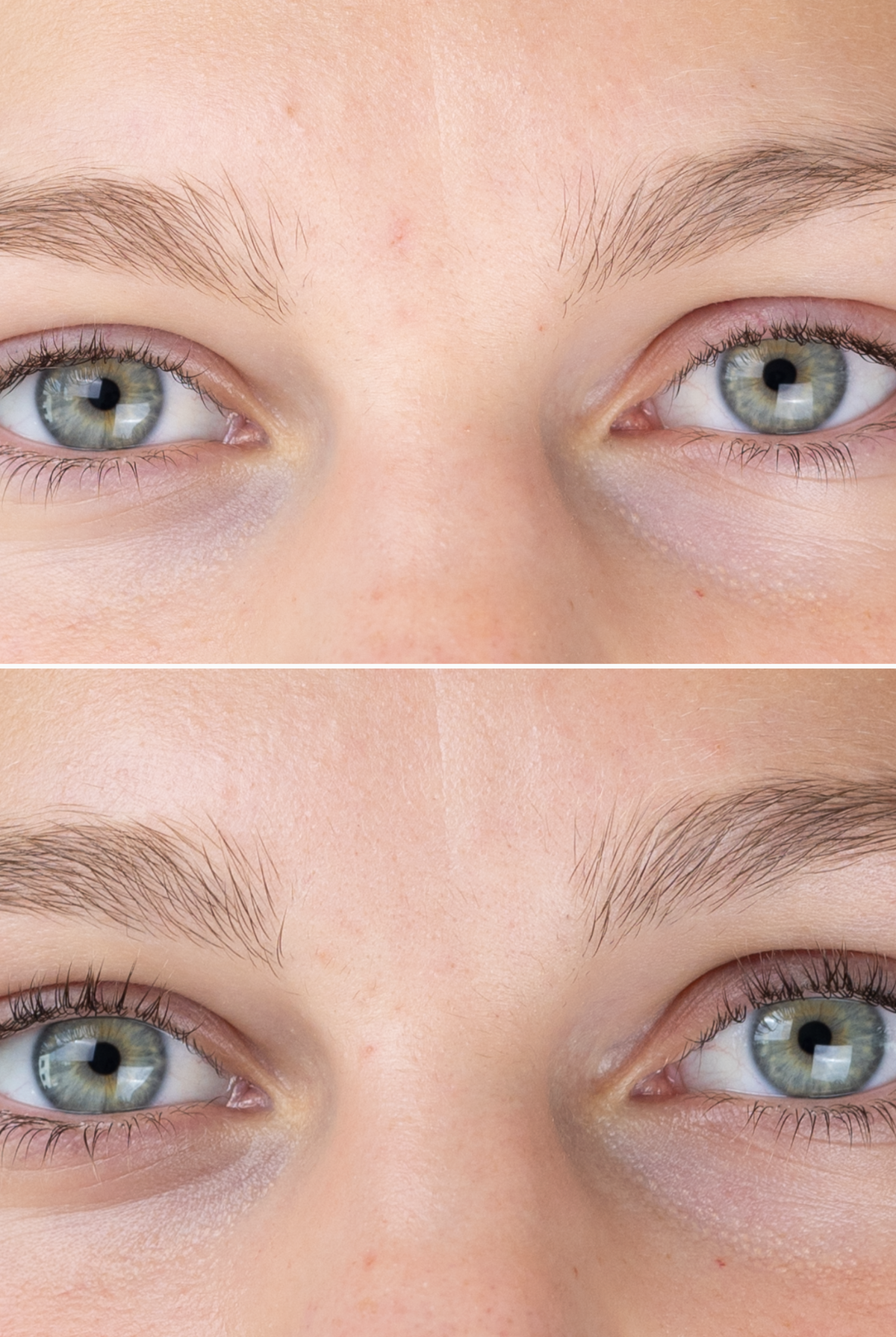 Sanzi Beauty“ blakstienų augimą skatinantis serumas (Eyelash Growth Serum) – efektyvi priemonė ilgesnėms, tankesnėms ir stipresnėms blakstienoms per 6–16 savaičių