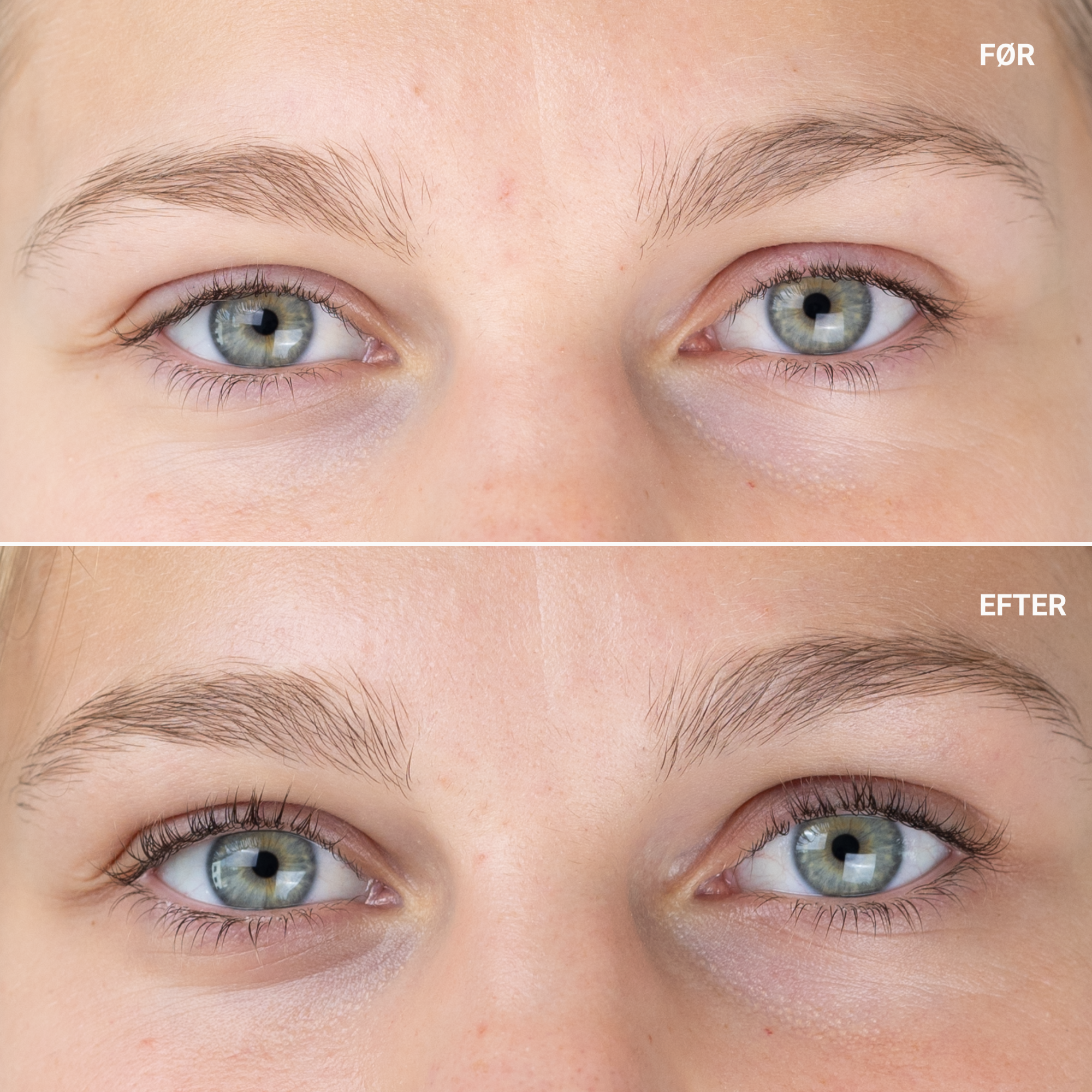 Sanzi Beauty“ blakstienų augimą skatinantis serumas (Eyelash Growth Serum) – efektyvi priemonė ilgesnėms, tankesnėms ir stipresnėms blakstienoms per 6–16 savaičių