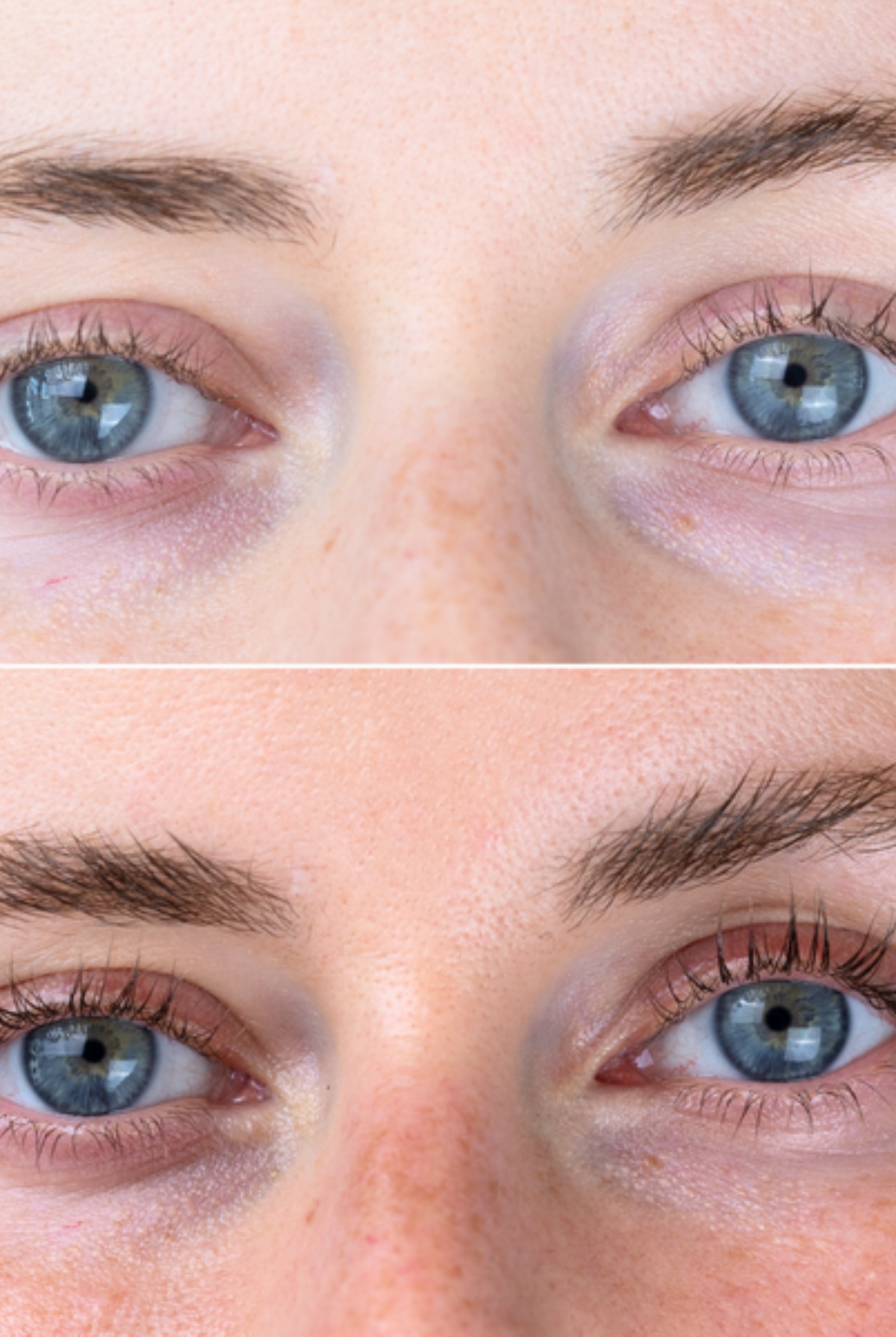 Sanzi Beauty“ blakstienų augimą skatinantis serumas (Eyelash Growth Serum) – efektyvi priemonė ilgesnėms, tankesnėms ir stipresnėms blakstienoms per 6–16 savaičių