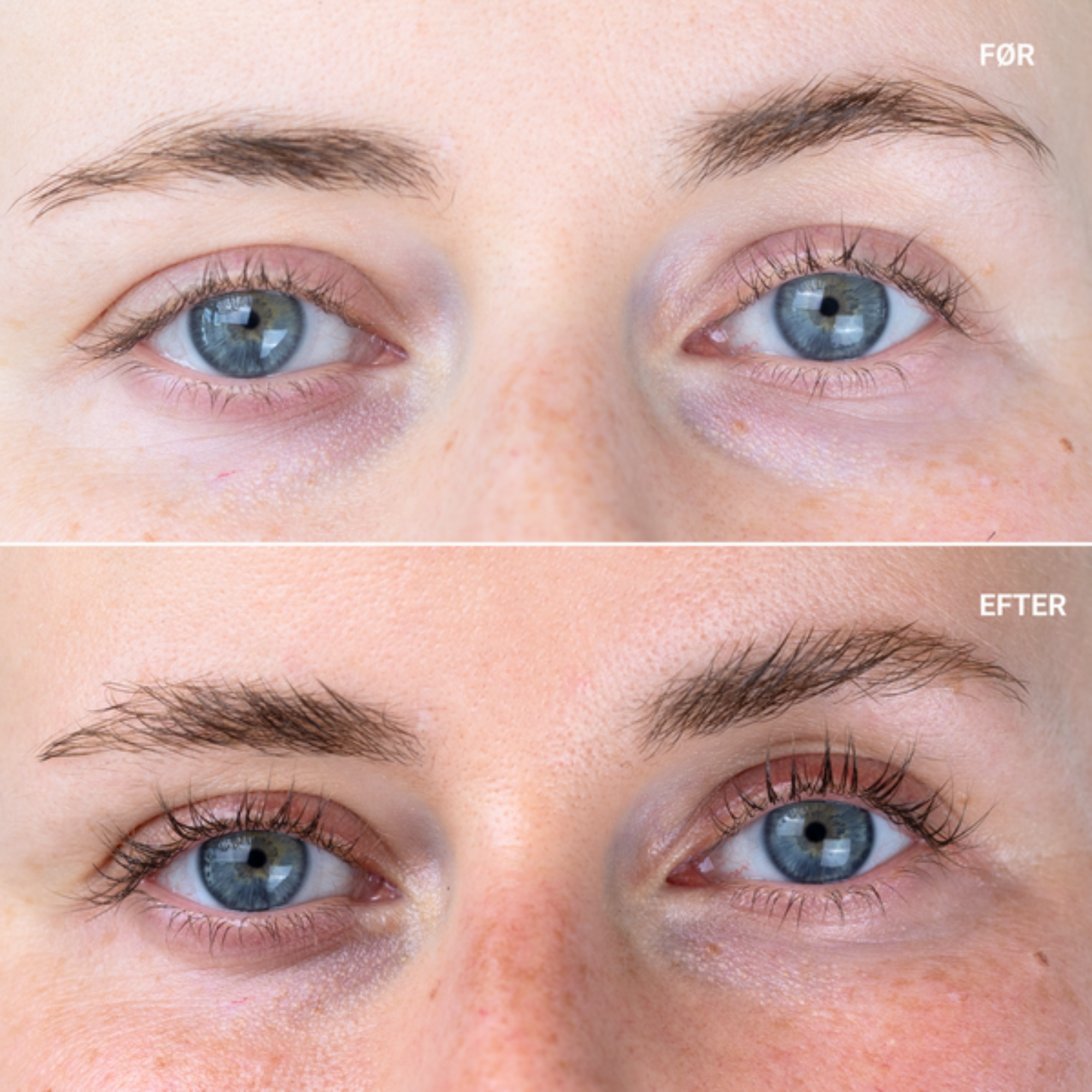 Sanzi Beauty“ blakstienų augimą skatinantis serumas (Eyelash Growth Serum) – efektyvi priemonė ilgesnėms, tankesnėms ir stipresnėms blakstienoms per 6–16 savaičių